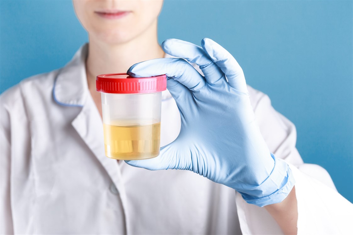 على ماذا يدلّ لون البول عند الأطفال؟