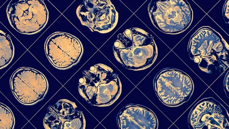 باحثون يكتشفون سبب الضيق في التنفس بعد التعافي من الكورونا