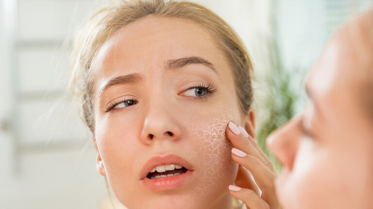 ثلاث علامات على الجلد يمكن أن تشير إلى نقص أحد المغذيات الأساسية  في الجسم