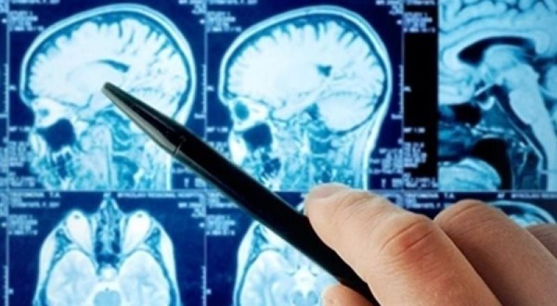 شيخوخة مبكرة.. فيروس كورونا يعود بأعراض جديدة تصيب المراهقين