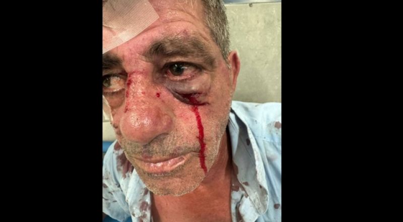 اعتداء عنصري جديد في طبريا: مراهقون يهاجمون سائق حافلة عربي