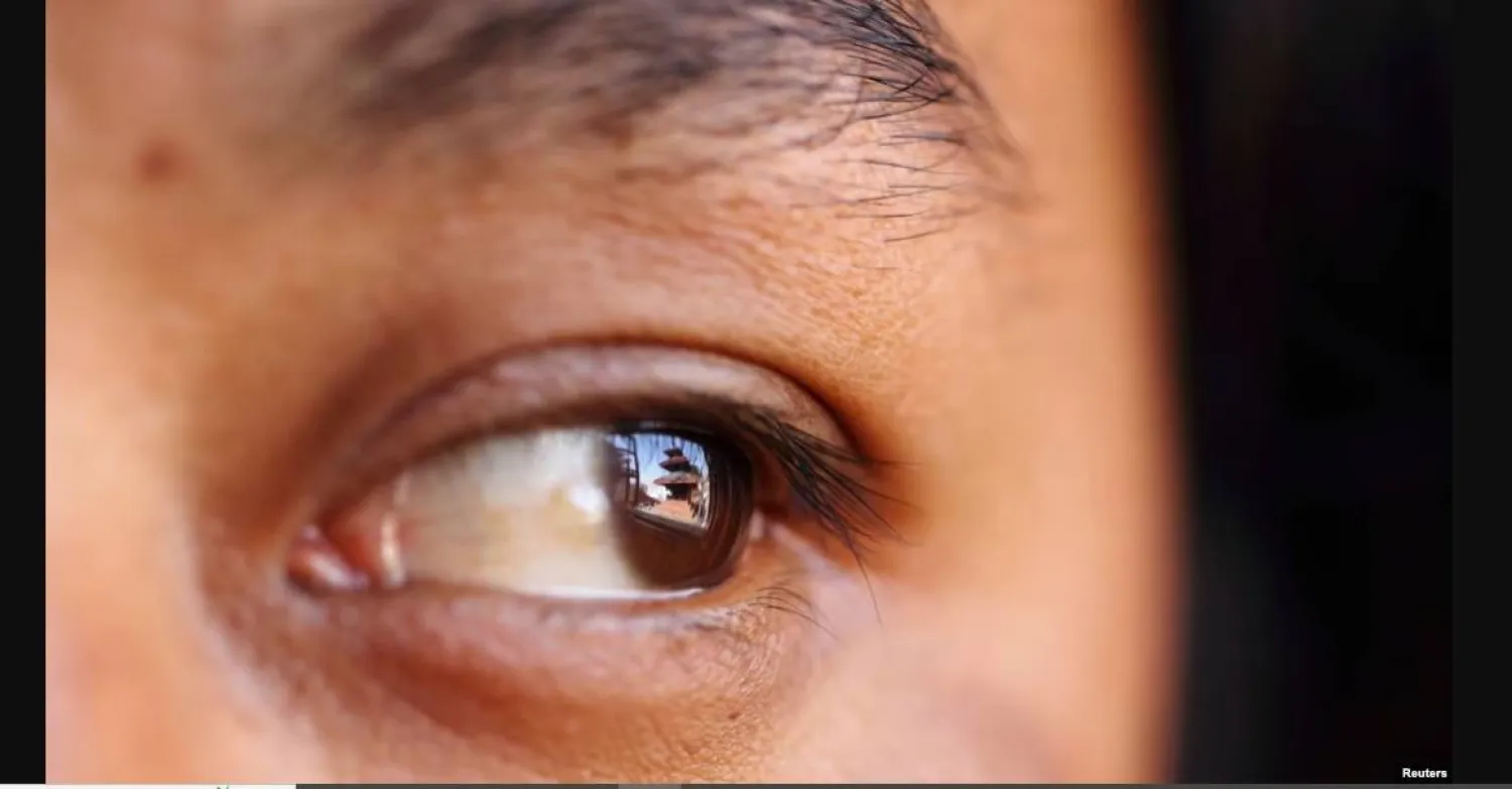 5 علامات مبكرة على «اعتلال الشبكية السكري» يجب الانتباه إليها