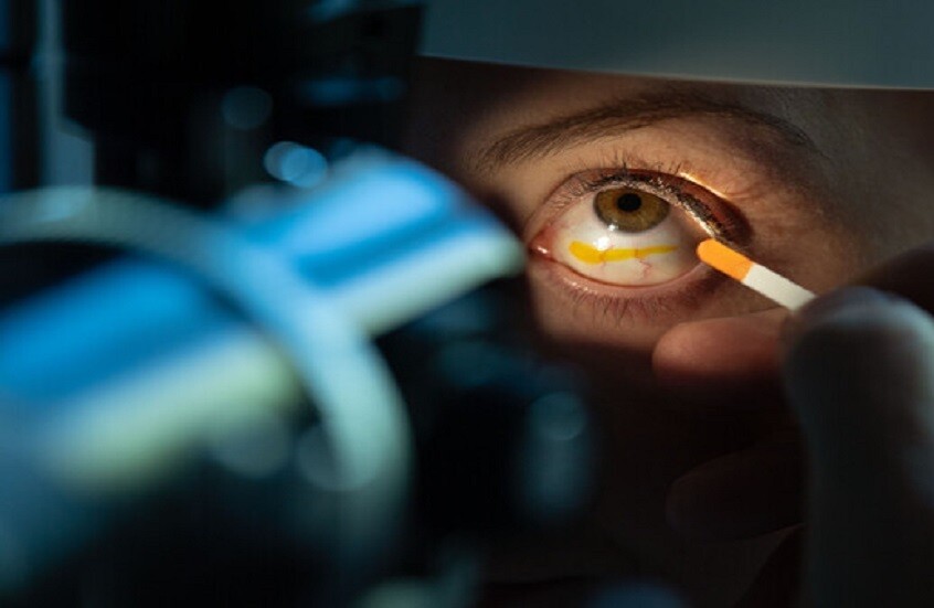 بعد سن الأربعين.. هل أنت من الفئات المعرضة لخطر الغلوكوما؟